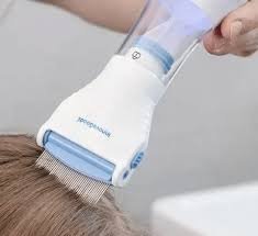 صورة الميزة